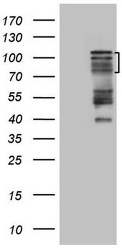 HIPK1 Monoclonal Antibody (OTI5F1), TrueMAB , OriGene 100 &mu;L; Unconjugated:Antibodies,