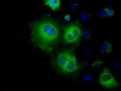 HK2 Mouse anti-Canine, Human, Clone: OTI4C5, lyophilized, TrueMAB 100 &mu;g;