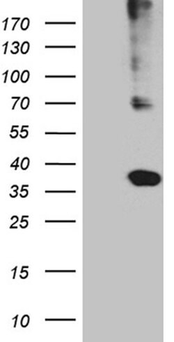 HLA Monoclonal Antibody (OTI4G7), TrueMAB , OriGene:Antibodies:Primary