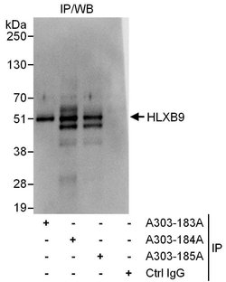 HLXB9 Rabbit anti-Human, Polyclonal, Bethyl Laboratories 100 &mu;L; Unconjugated:Antibodies,