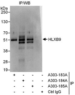HLXB9 Rabbit anti-Human, Polyclonal, Bethyl Laboratories 100 &mu;L; Unconjugated:Antibodies,