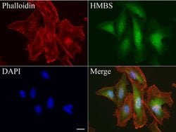 HMBS Mouse anti-Human, Clone: UMAB144, lyophilized, UltraMAB 100 &mu;g;