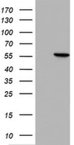 HMBS Monoclonal Antibody (OTI2F4), TrueMAB , OriGene 100 &mu;L; Unconjugated:Antibodies,