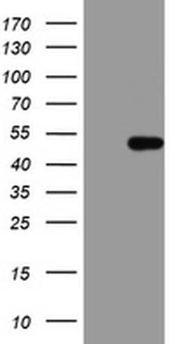 HMBS Monoclonal Antibody (OTI1F1), TrueMAB , OriGene:Antibodies:Primary