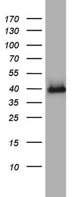HMBS Monoclonal Antibody (OTI1F1), TrueMAB , OriGene 100 &mu;L; Unconjugated:Antibodies,