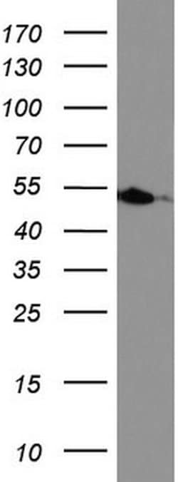 HMBS Mouse anti-Human, Clone: UMAB144, lyophilized, UltraMAB 100 &mu;g;