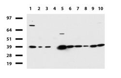 HMBS Mouse anti-Human, Clone: UMAB144, lyophilized, UltraMAB 100 &mu;g;