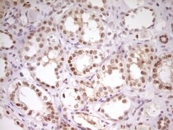HMG20A Monoclonal Antibody (OTI5E4), TrueMAB , OriGene:Antibodies:Primary