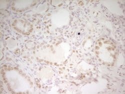 HMG20A Monoclonal Antibody (OTI5E3), TrueMAB , OriGene 100 &mu;L; Unconjugated:Antibodies,