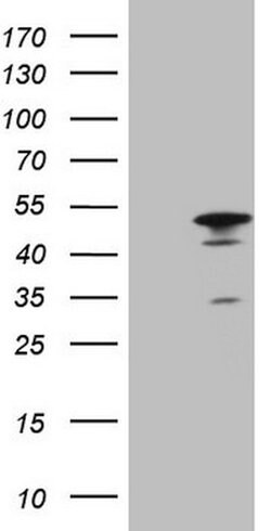 HMG20A Mouse anti-Human, Clone: OTI5G3, lyophilized, TrueMAB 100 &mu;g;