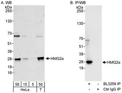 HMG2a Rabbit anti-Human, Mouse, Polyclonal, Bethyl Laboratories 100 &mu;l;