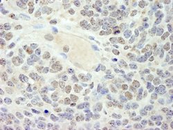 HMG2a Polyclonal Antibody, Bethyl Laboratories 100 &mu;L; Unconjugated:Antibodies,