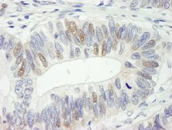 HMG2a Polyclonal Antibody, Bethyl Laboratories 100 &mu;L; Unconjugated:Antibodies,