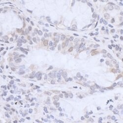 HMGN3 Rabbit anti-Human, Polyclonal, Bethyl Laboratories 10 &mu;L; Unconjugated:Antibodies,