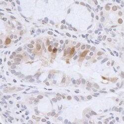 HMGN3 Rabbit anti-Human, Polyclonal, Bethyl Laboratories 100 &mu;L; Unconjugated:Antibodies,