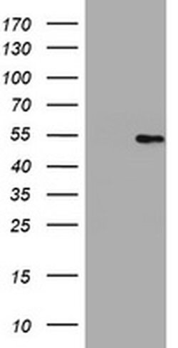 HMGXB4 Monoclonal Antibody (OTI1H9), TrueMAB , OriGene 100 &mu;L | Buy Online | Origene Technologies | Fisher Scientific