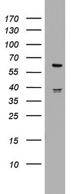 HMGXB4 Monoclonal Antibody (OTI1H10), TrueMAB , OriGene 100 &mu;L; Unconjugated:Antibodies,