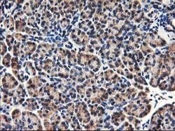 HMOX2 Monoclonal Antibody (OTI1H10), TrueMAB , OriGene 100 &mu;L; Unconjugated:Antibodies,