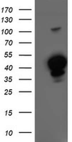 HMOX2 Monoclonal Antibody (OTI1B4), TrueMAB , OriGene 100 &mu;L; Unconjugated:Antibodies,