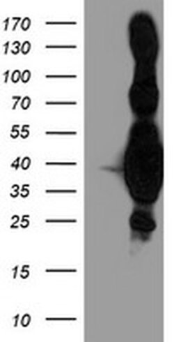 HMOX2 Monoclonal Antibody (OTI1H10), TrueMAB , OriGene 100 &mu;L; Unconjugated:Antibodies,