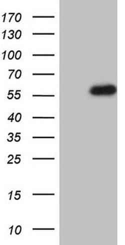 HNF4A Monoclonal Antibody (OTI5A9), TrueMAB , OriGene:Antibodies:Primary