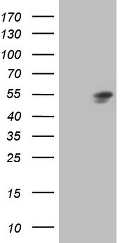 HNF4A Mouse anti-Human, Clone: OTI2C10, lyophilized, TrueMAB 100 &mu;g;