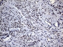 HNRNPA0 Monoclonal Antibody (OTI8H8), TrueMAB , OriGene 100 &mu;L; Unconjugated:Antibodies,