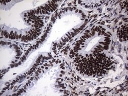 HNRNPA0 Monoclonal Antibody (OTI8H8), TrueMAB , OriGene 100 &mu;L; Unconjugated:Antibodies,