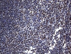 HNRNPA0 Monoclonal Antibody (OTI8H8), TrueMAB , OriGene 100 &mu;L; Unconjugated:Antibodies,