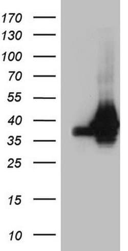 HNRNPA0 Monoclonal Antibody (OTI8H8), TrueMAB , OriGene 100 &mu;L; Unconjugated:Antibodies,