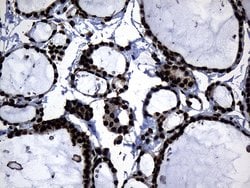 HNRNPH1 Monoclonal Antibody (OTI2D11), TrueMAB , OriGene:Antibodies:Primary