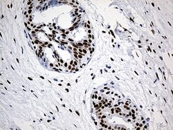 HNRNPH1 Monoclonal Antibody (OTI5D11), TrueMAB , OriGene 100 &mu;L; Unconjugated:Antibodies,