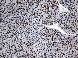 HNRNPH1 Monoclonal Antibody (OTI5D11), TrueMAB , OriGene 100 &mu;L; Unconjugated:Antibodies,
