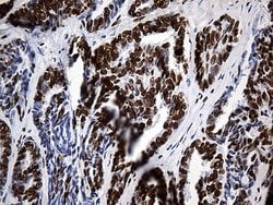 HNRNPH1 Monoclonal Antibody (OTI5D11), TrueMAB , OriGene 100 &mu;L; Unconjugated:Antibodies,