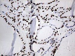 HNRNPH1 Monoclonal Antibody (OTI5D11), TrueMAB , OriGene 100 &mu;L; Unconjugated:Antibodies,