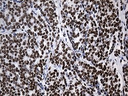 HNRNPH1 Monoclonal Antibody (OTI5D11), TrueMAB , OriGene 100 &mu;L; Unconjugated:Antibodies,