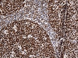 HNRNPH1 Monoclonal Antibody (OTI5D11), TrueMAB , OriGene 100 &mu;L; Unconjugated:Antibodies,