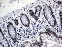 HNRNPH1 Monoclonal Antibody (OTI5D11), TrueMAB , OriGene 100 &mu;L; Unconjugated:Antibodies,