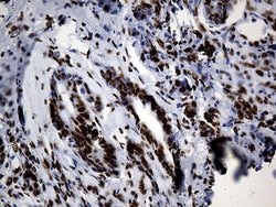 HNRNPH1 Monoclonal Antibody (OTI5D11), TrueMAB , OriGene 100 &mu;L; Unconjugated:Antibodies,