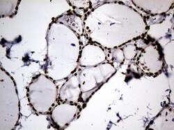 HNRNPH1 Monoclonal Antibody (OTI1H3), TrueMAB , OriGene 100 &mu;L; Unconjugated:Antibodies,