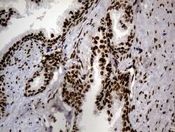 HNRNPH1 Monoclonal Antibody (OTI1H3), TrueMAB , OriGene 100 &mu;L; Unconjugated:Antibodies,