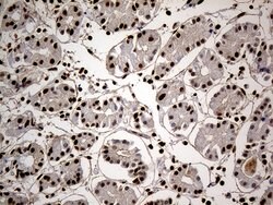 HNRNPH1 Monoclonal Antibody (OTI1H3), TrueMAB , OriGene 100 &mu;L; Unconjugated:Antibodies,