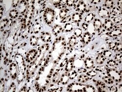 HNRNPH1 Monoclonal Antibody (OTI1H3), TrueMAB , OriGene 100 &mu;L; Unconjugated:Antibodies,