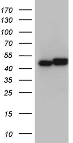 HNRNPH1 Monoclonal Antibody (OTI1H3), TrueMAB , OriGene 100 &mu;L; Unconjugated:Antibodies,