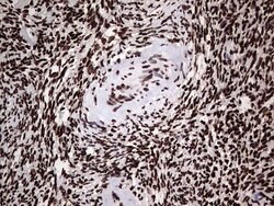 HNRNPL Mouse anti-Human, Clone: OTI2E4, lyophilized, TrueMAB 100 &mu;g;