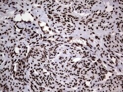 HNRNPL Mouse anti-Human, Clone: OTI2E4, lyophilized, TrueMAB 100 &mu;g;
