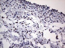 HNRNPL Mouse anti-Human, Clone: OTI2E4, lyophilized, TrueMAB 100 &mu;g;