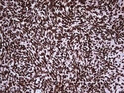 HNRNPL Mouse anti-Human, Clone: OTI9G7, lyophilized, TrueMAB 100 &mu;g;