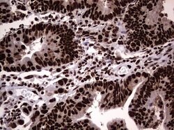 HNRNPL Mouse anti-Human, Clone: OTI9G7, lyophilized, TrueMAB 100 &mu;g;