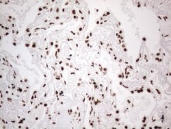 HNRNPL Monoclonal Antibody (OTI4E5), TrueMAB , OriGene 100 &mu;L; Unconjugated:Antibodies,
